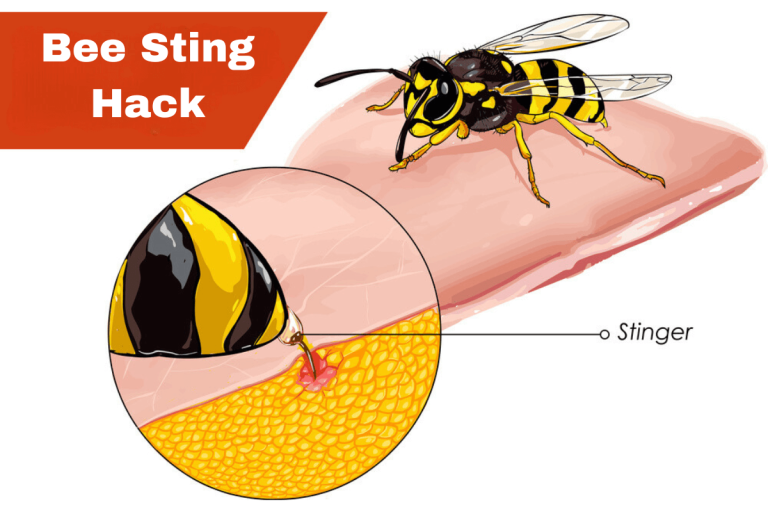 Natural Bee Sting Remedy - Works Like Magic! 19 Bee sting hack illustration: close-up of stinger injecting venom into skin